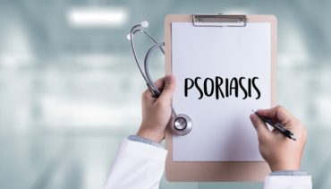 doctor writes the word psoriasis on his pad
