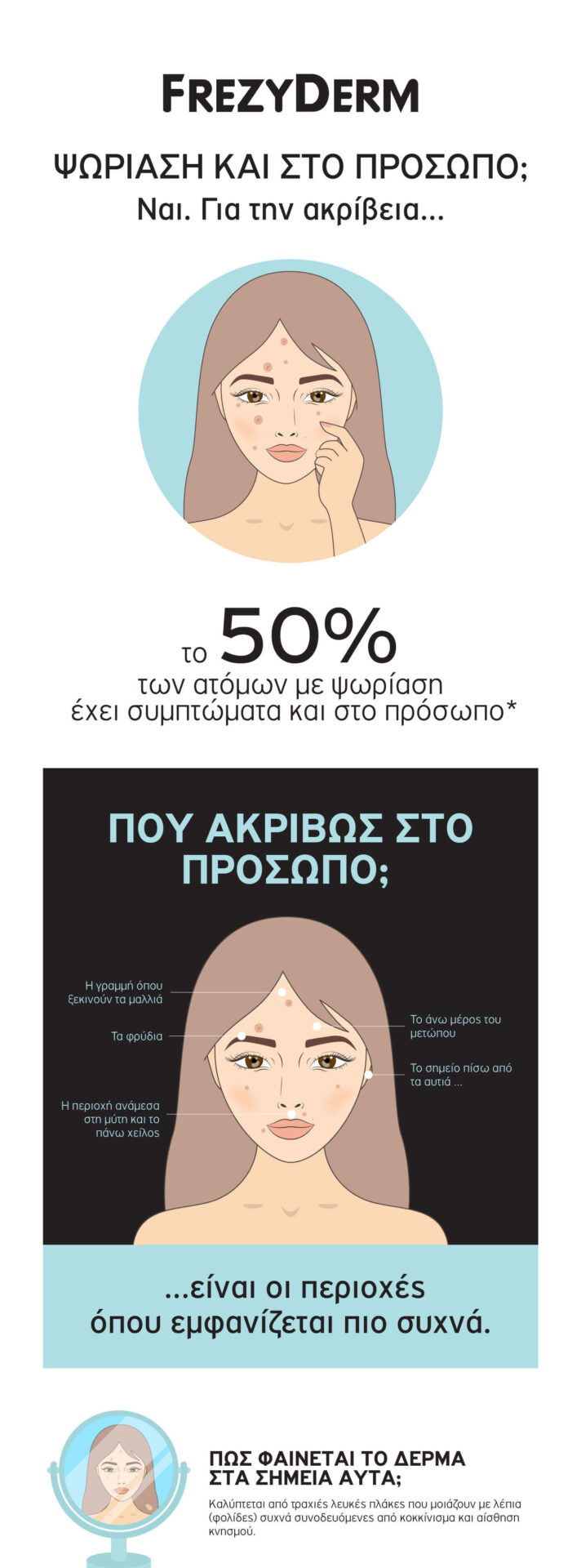 psoriasis infographic 1