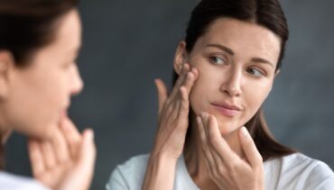 Woman with acne touching her face