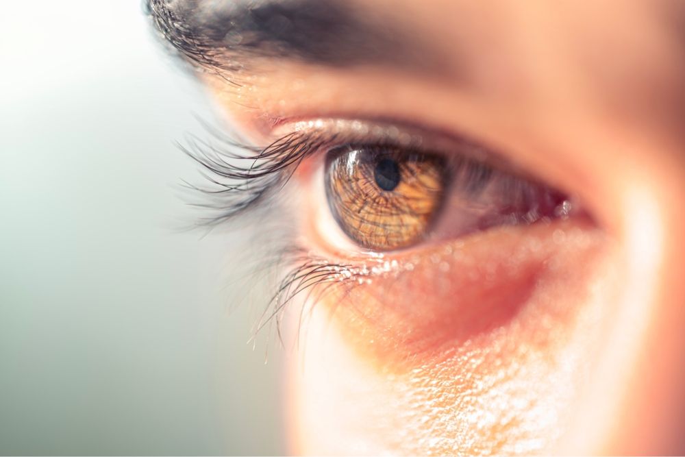 Γιατί πέφτουν οι βλεφαρίδες; WOMAN EYES